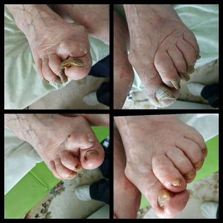 Гигиенический и эстетический педикюр (выезд на дом