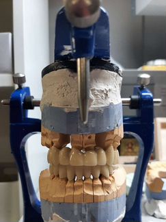 Зубной техник.Стоматология-Ортопедия